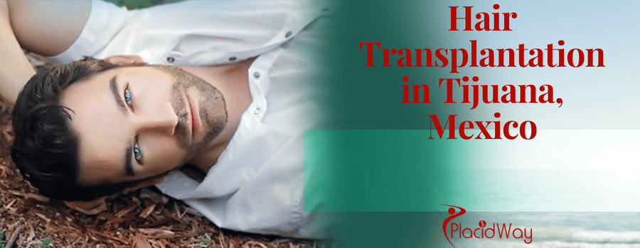 Hair Transplantation in Tijuana, Mexico